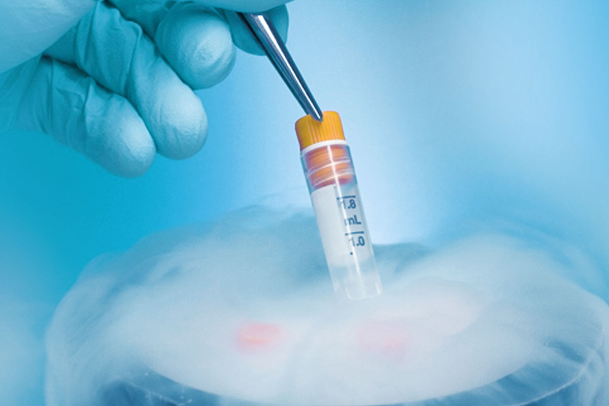 Sperm and egg freezing in Thailand