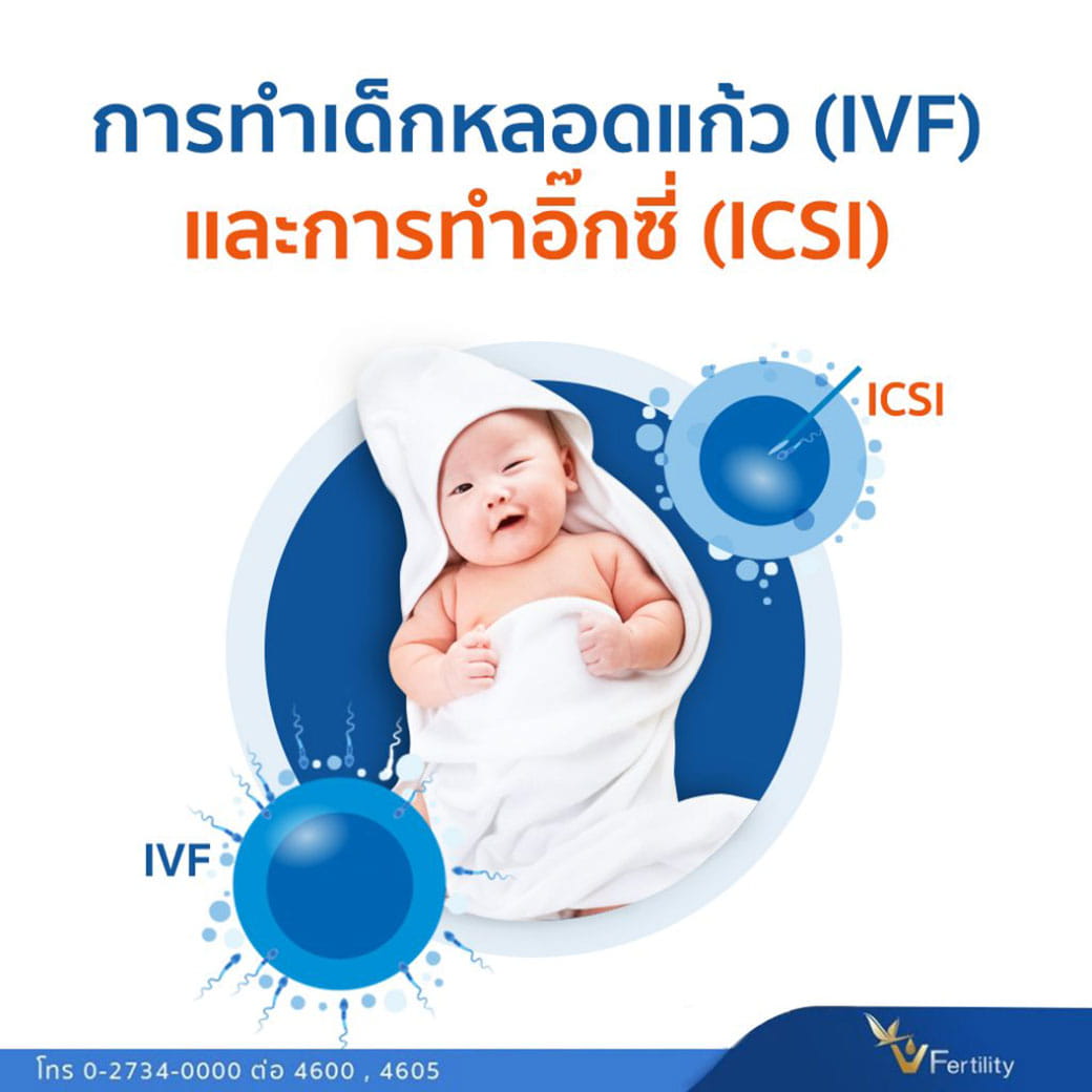 การทำเด็กหลอดแก้ว (IVF) และการทำอิ๊กซี่ (ICSI)