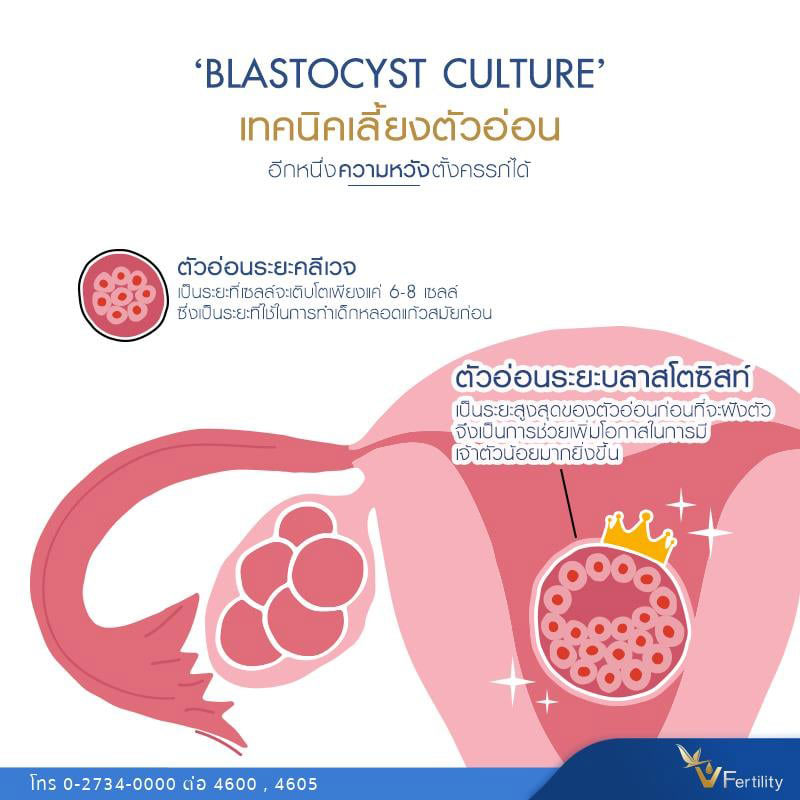Blastocyst Culture เทคนิคเลี้ยงตัวอ่อน