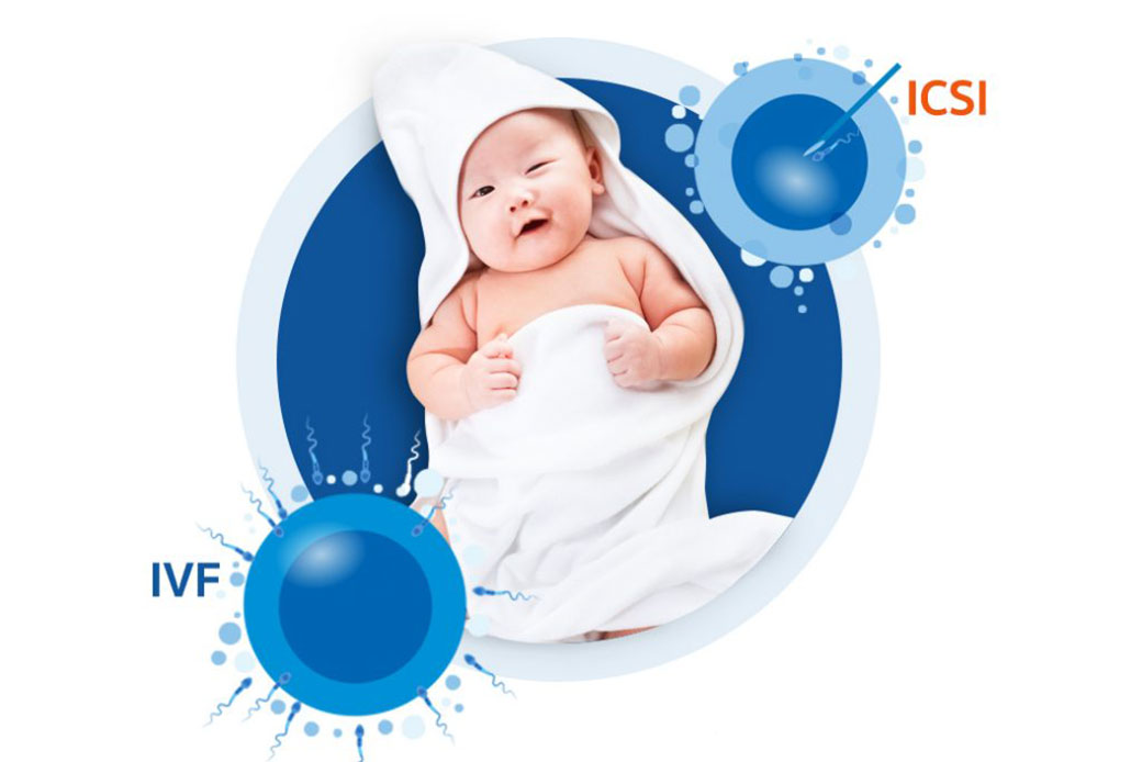 การทำเด็กหลอดแก้ว (IVF) และการทำอิ๊กซี่ (ICSI)