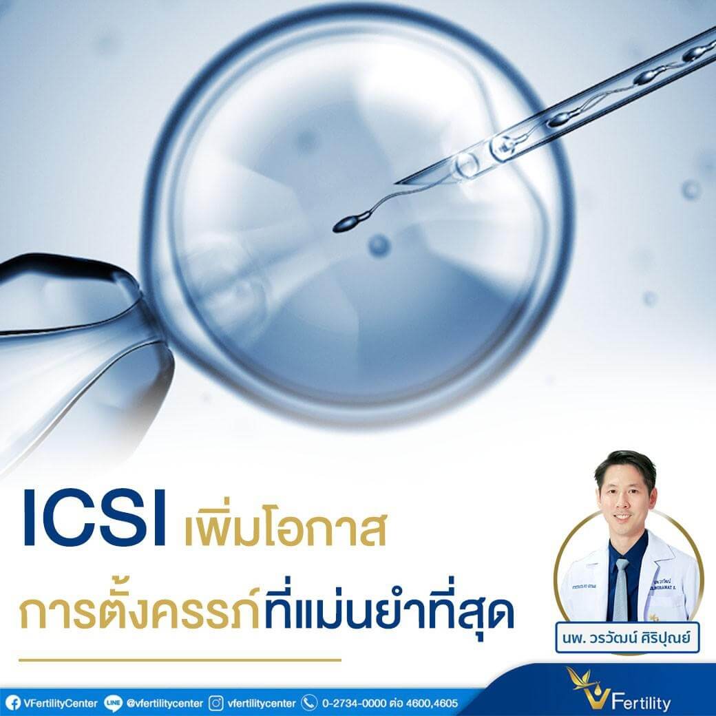 ICS เพิ่มโอกาสการตั้งครรภ์ที่แม่นยำที่สุด