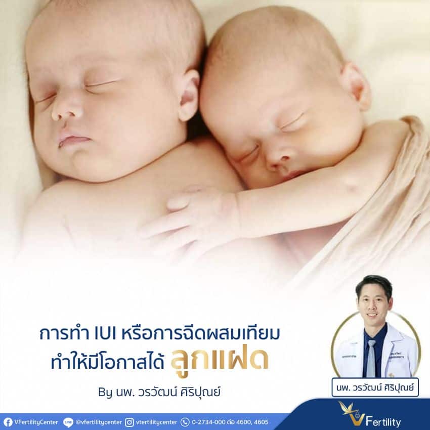 การทำ IUI หรือการฉีดผสมเทียมทำให้มีโอกาสได้ลูกแฝด