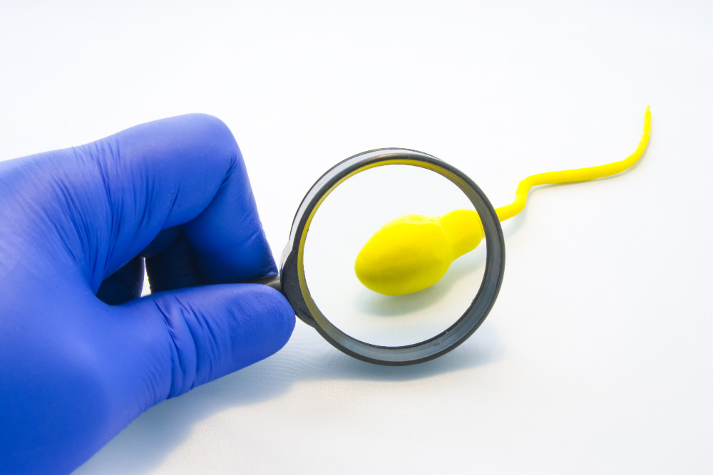 There are many options available for sperm retrieval for your IVF treatment.