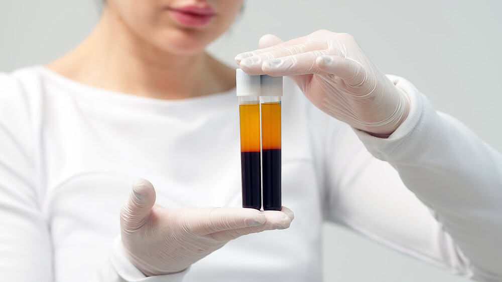 เจ้าหน้าที่เตรียม PRP สำหรับฉีดฟื้นฟูรังไข่