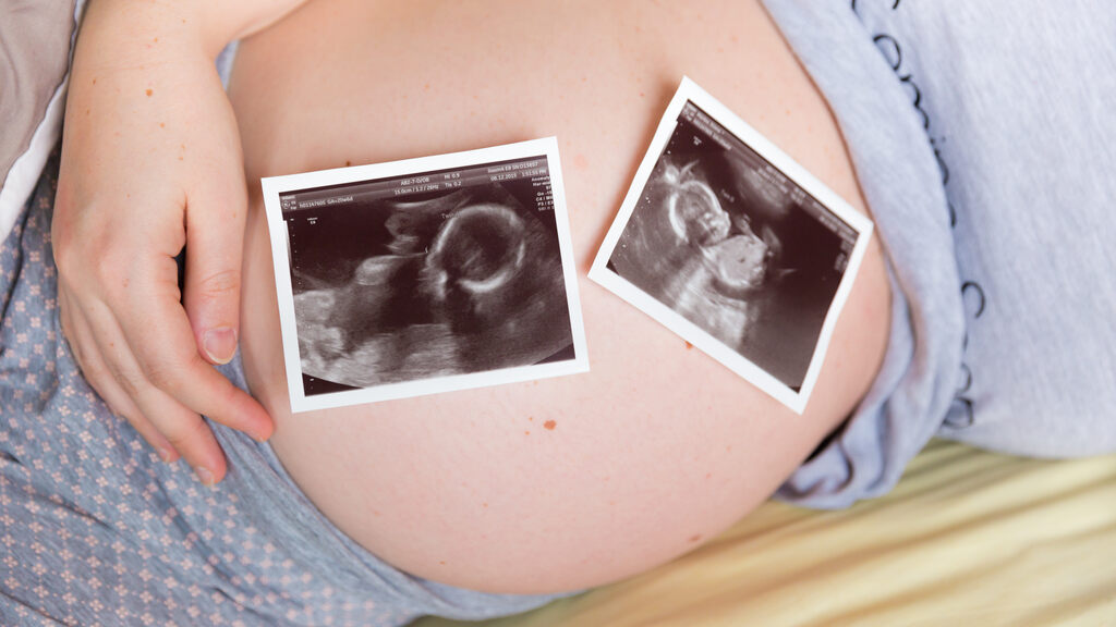 วิธีเพิ่มโอกาสตั้งครรภ์แฝด