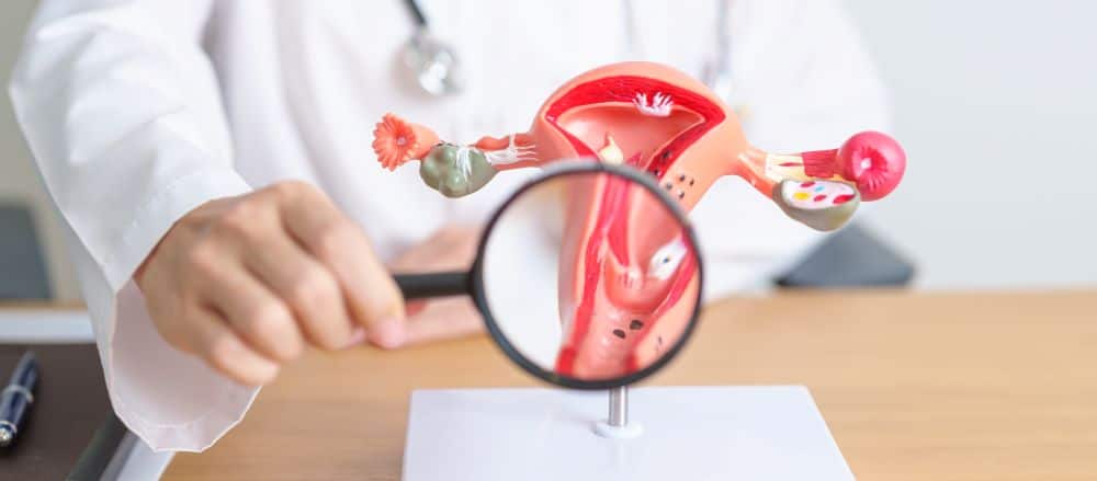 โรค PCOS คือ ความผิดปกติของระบบฮอร์โมนที่ทำให้ผู้ป่วยมีถุงน้ำในรังไข่หลายใบ
