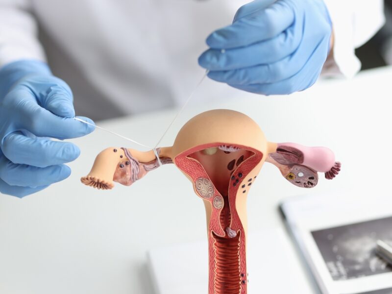 A doctor demonstrates the concept of tubal ligation.