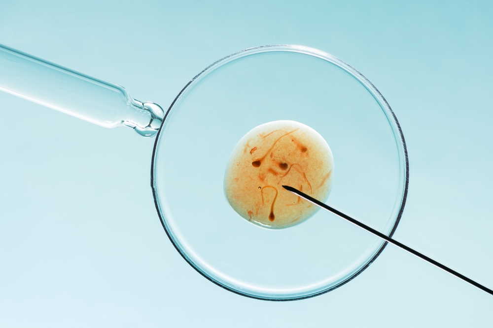 An IVF program can rely on successful sperm retrieval.