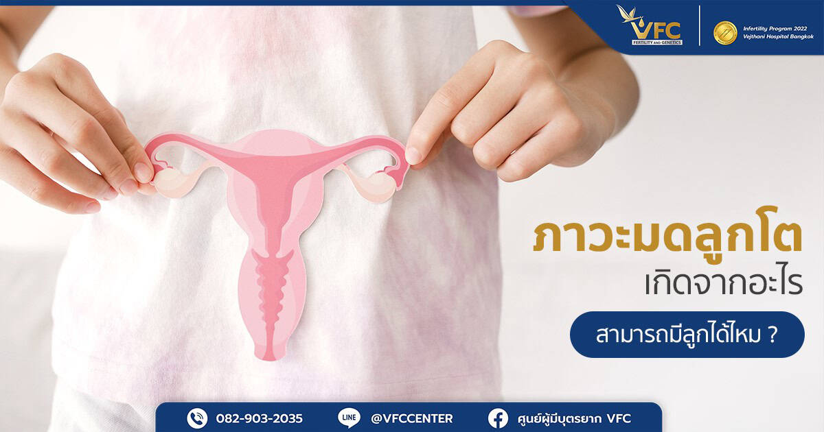 Adenomyosis คือ โรคมดลูกโตจากเยื่อบุโพรงมดลูกเจริญผิดที่