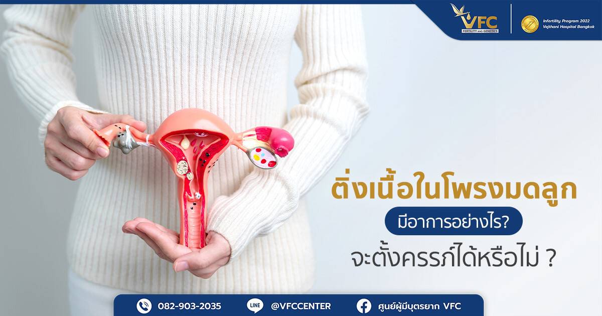 ผู้หญิงกังวลเป็นติ่งเนื้อในโพรงมดลูก สามารถตั้งครรภ์ได้หรือไม่ ?