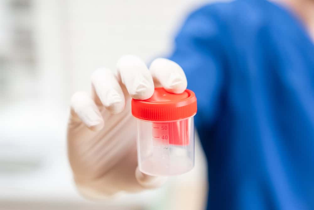 A medical technician holding a semen sample container