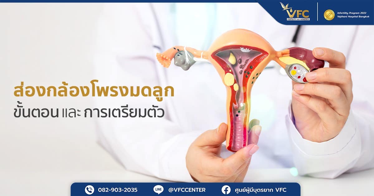 แพทย์กำลังอธิบายการส่องกล้องโพรงมดลูก