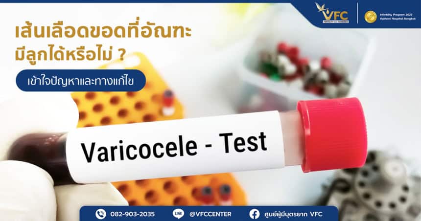 การตรวจเลือดเพื่อวิเคราะห์ว่าเส้นเลือดขอดที่อัณฑะมีลูกได้หรือไม่