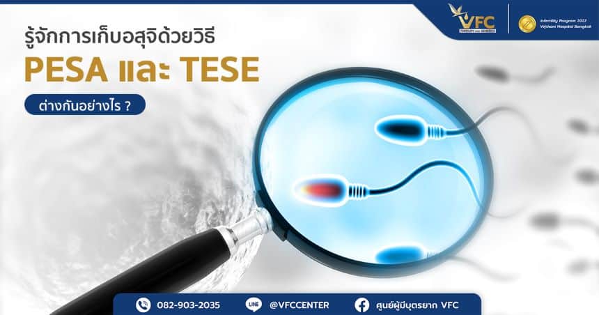 การเก็บอสุจิและคัดเลือกอสุจิที่สมบูรณ์เพื่อนำไปทำเด็กหลอดแก้ว