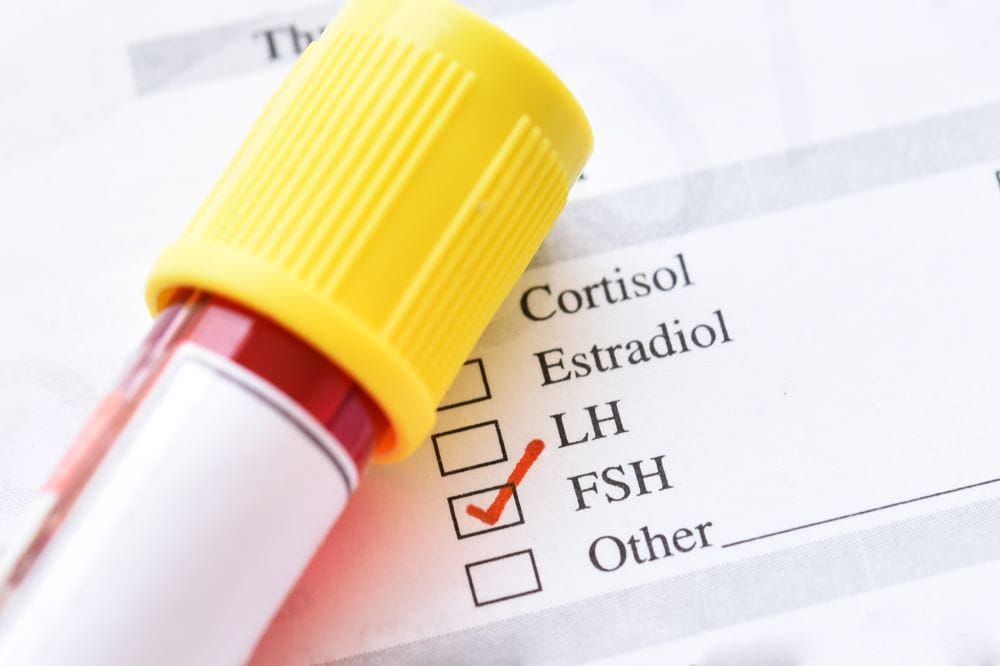ฮอร์โมน FSH (Follicle Stimulating Hormone) คือฮอร์โมนกระตุ้นการเจริญของไข่