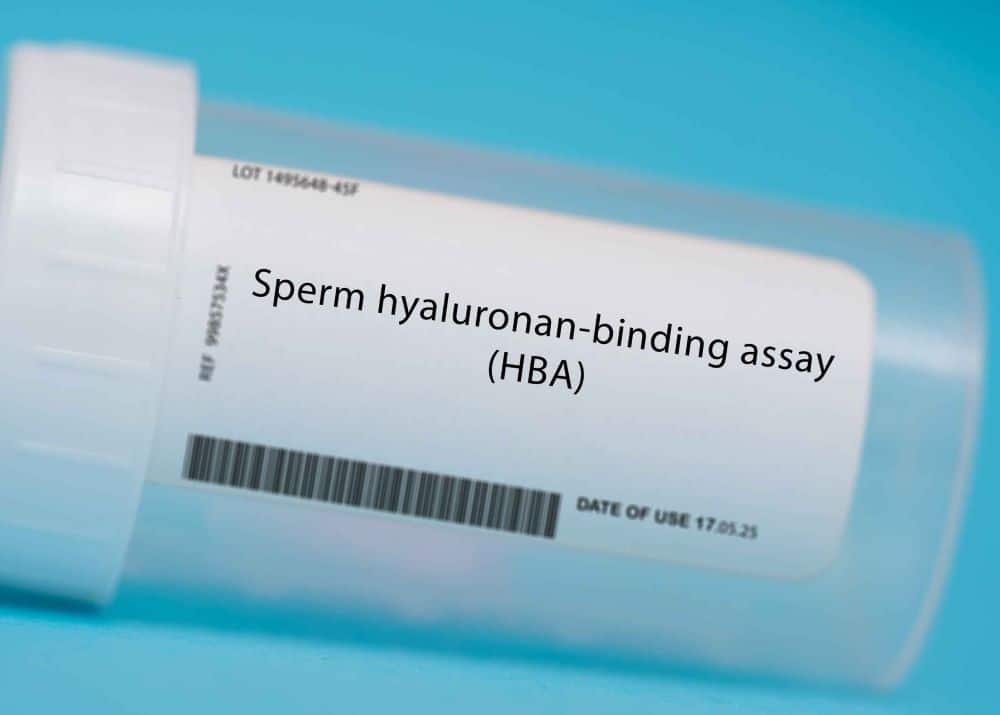 HBA Test คือการทดสอบความสามารถในการจับกับสารไฮยาลูรอนิก แอซิดของตัวอสุจิ