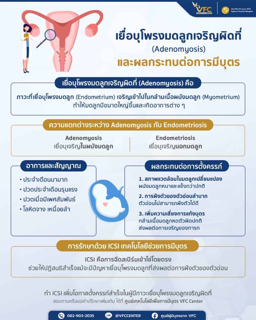 โรคเยื่อบุโพรงมดลูกเจริญผิดที่ หรือ Adenomyosis กับโอกาสการมีบุตร1