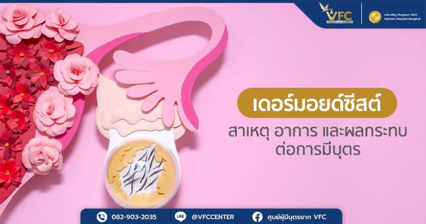 ภาพจำลองของเดอร์มอยด์ซีสต์ คือซีสต์ที่มีเนื้อเยื่อ ผม ฟัน และกระดูกอยู่ภายใน
