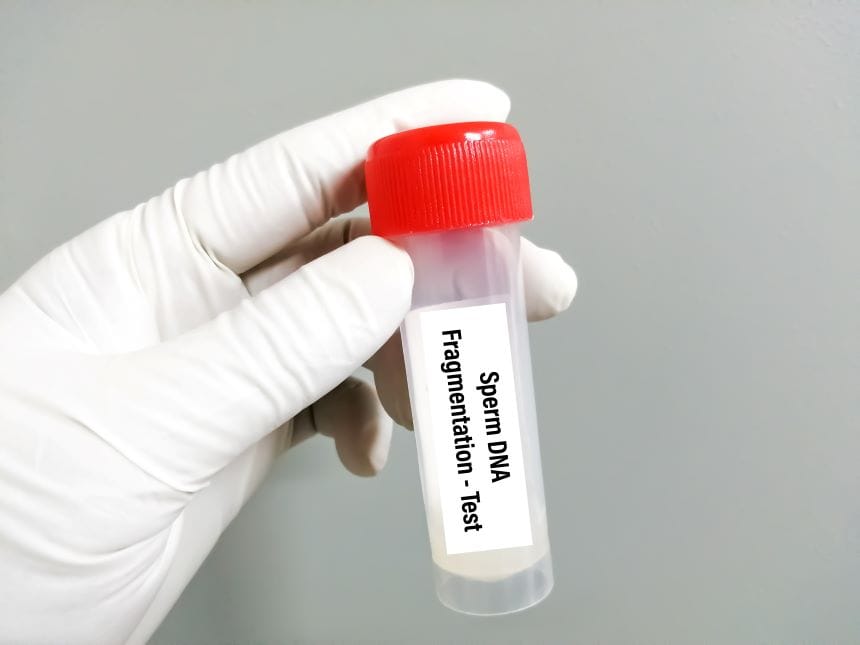 หลอดเก็บตัวอย่างน้ำเชื้อเพื่อนำไปตรวจหา DNA Fragmentation
