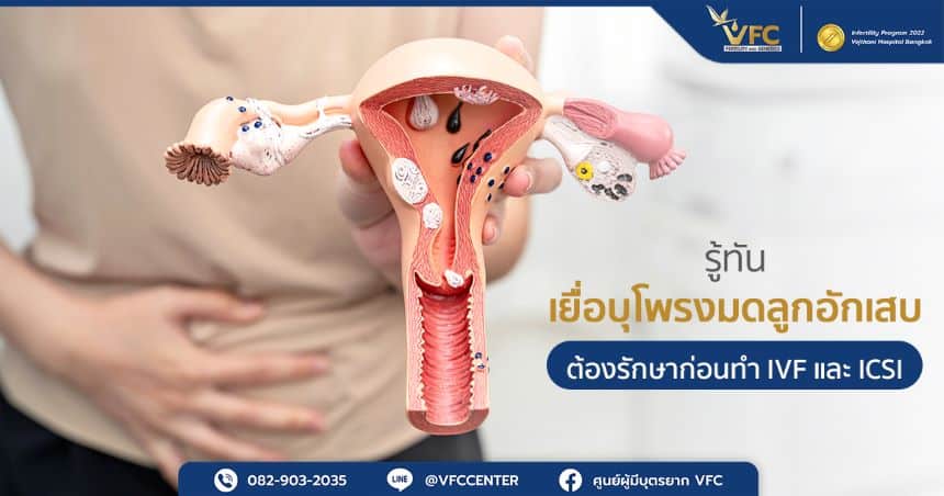 เยื่อบุโพรงมดลูกอักเสบ (Endometritis) คือภาวะที่มักเกิดจากการติดเชื้อในช่องคลอด