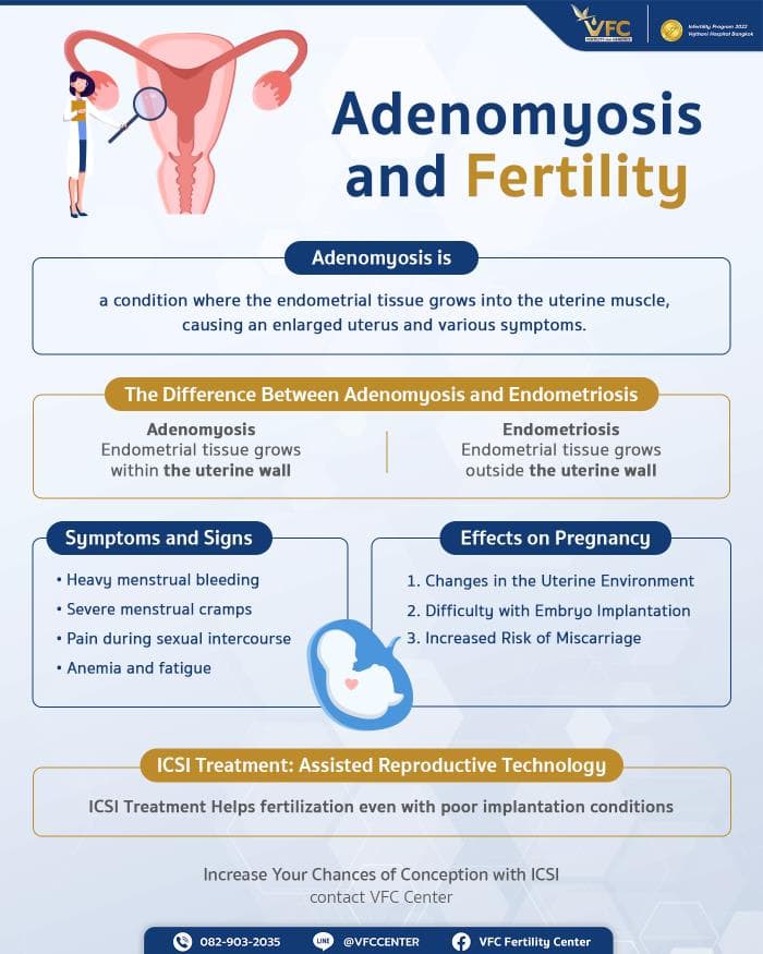Adenomyosis and Its Impact on Fertility