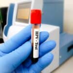 ารตรวจเชื้อ HPV เป็นหนึ่งในรายการตรวจสุขภาพที่ควรตรวจเมื่อวางแผนตั้งครรภ์