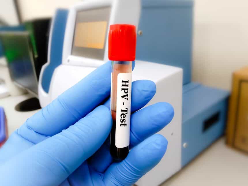 ารตรวจเชื้อ HPV เป็นหนึ่งในรายการตรวจสุขภาพที่ควรตรวจเมื่อวางแผนตั้งครรภ์