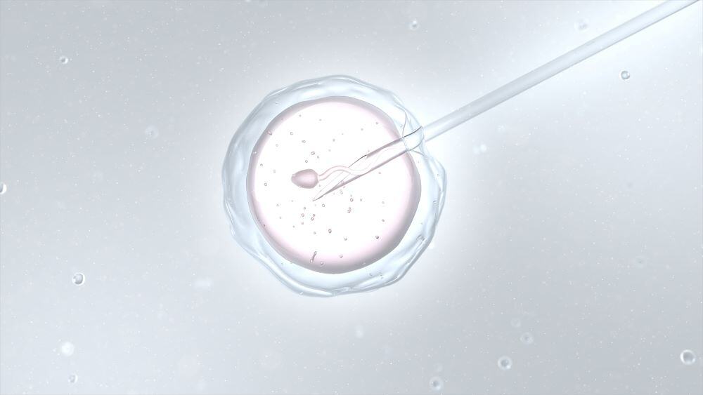 ICSI คือการฉีดสเปิร์มตัวเดียวเข้าไปในไข่โดยตรง เหมาะกับกรณีที่เคยทำวิธี IVF แบบเดิมแล้วไม่สำเร็จ