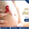 คู่รักที่มีเชื้อ HIV มีลูกที่ปลอดเชื้อได้เมื่อควบคุมเชื้อให้อยู่ในระดับตรวจไม่พบร่วมกับการทำ ICSI