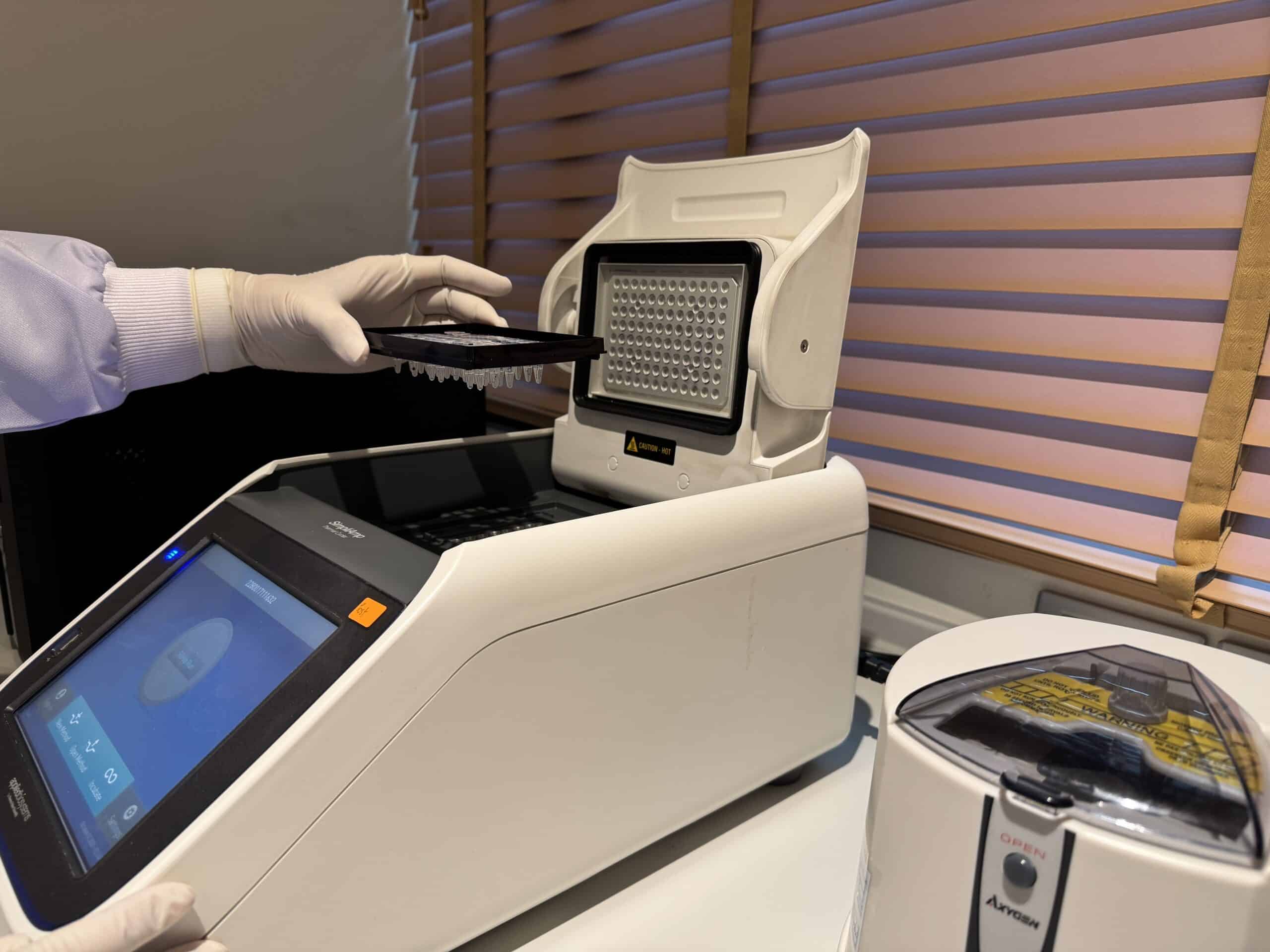 Lab assessment of the FSHR test from a blood sample.