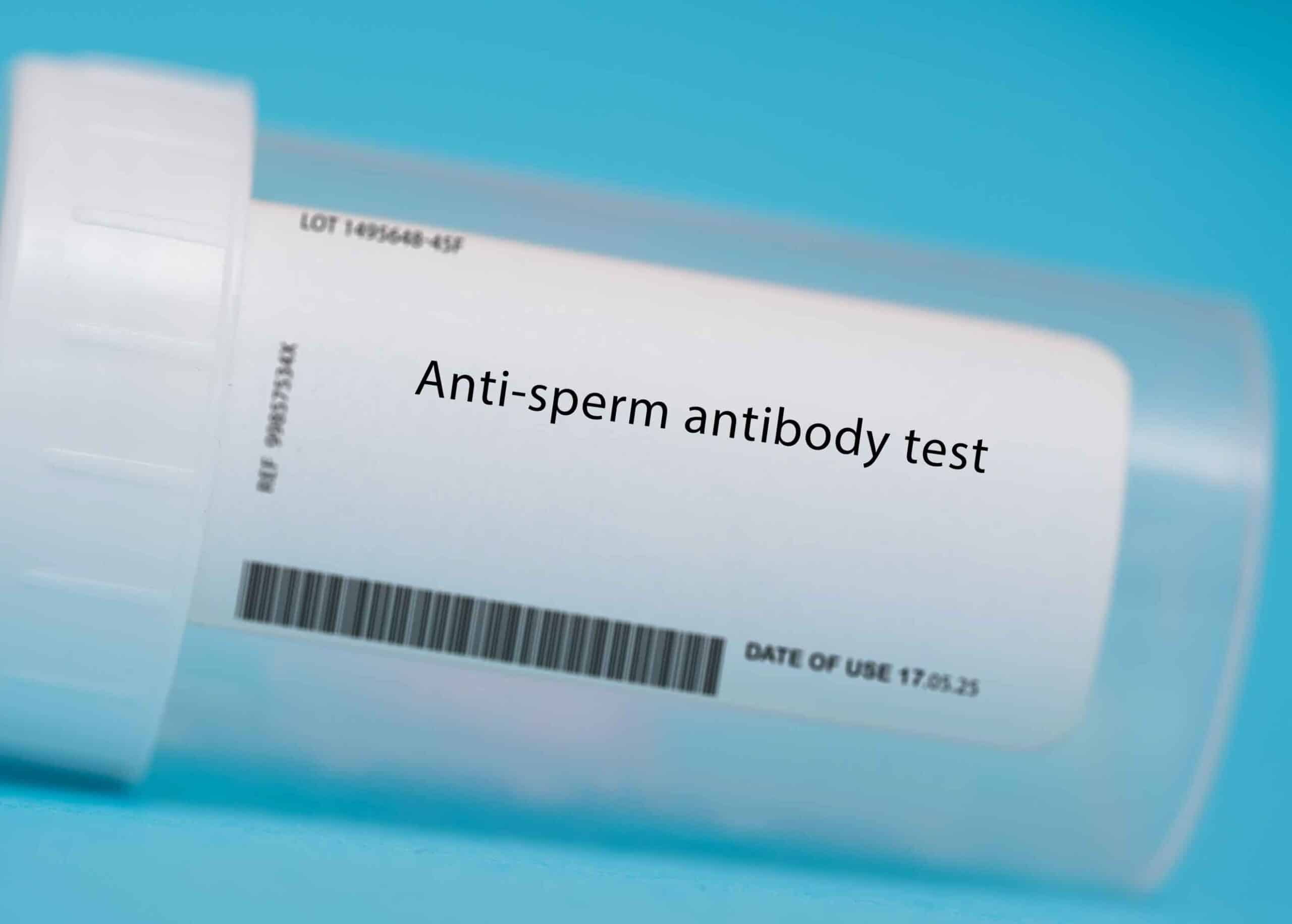 การตรวจหาแอนติบอดีอสุจิเพื่อหาสาเหตุการมีบุตรยาก