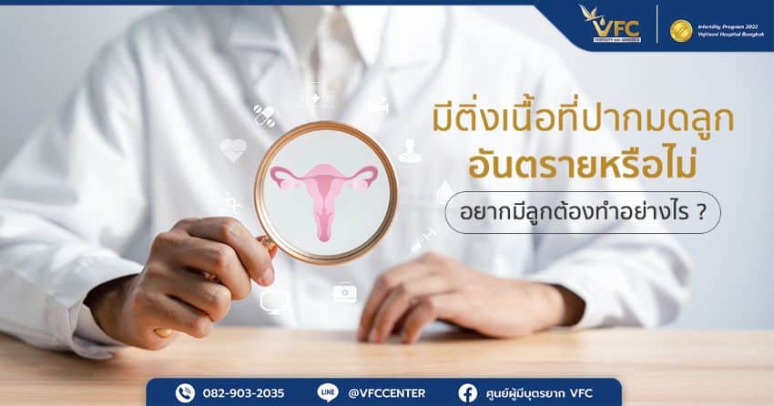 ภาพสื่อถึงการตรวจภายในที่ทำให้รู้ว่ามีติ่งเนื้อที่ปากมดลูก หรือไม่