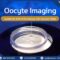 Oocyte Imaging with AI is used in the analysis of egg quality under microscope before the ICSI procedure.
