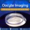 Oocyte Imaging with AI is used in the analysis of egg quality under microscope before the ICSI procedure.