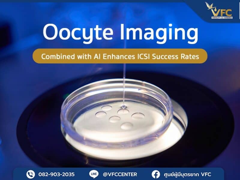Oocyte Imaging with AI is used in the analysis of egg quality under microscope before the ICSI procedure.