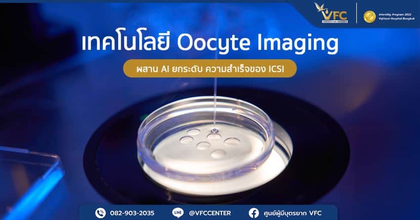 การนำตัวอย่างไข่มาทำ Oocyte Imaging ผสาน AI ในกระบวนการวิเคราะห์คุณภาพของไข่ก่อนทำ ICSI