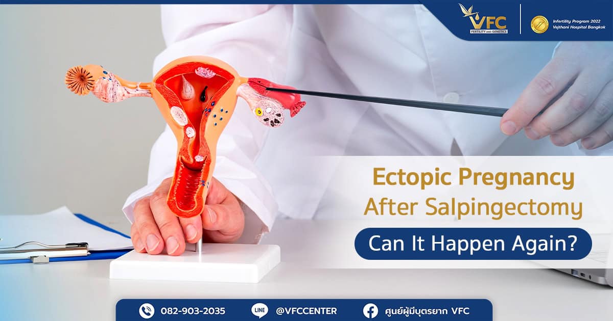 octor pointing to the fallopian tube, the common implantation site in ectopic pregnancy