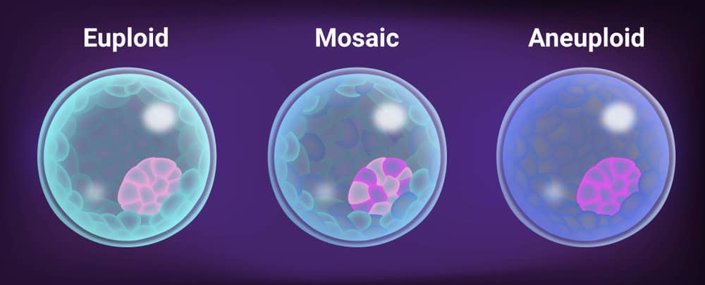 SNP-based PGT-A detecting embryo abnormalities with high accuracy