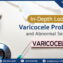 Diagnostic and Treatment Approach for Varicocele Problems