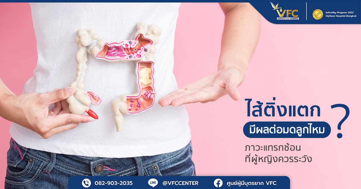 ผู้หญิงถือโครงสร้างจำลองลำไส้และไส้ติ่ง พร้อมกับมีข้อสงสัยว่า เคยผ่าตัดไส้ติ่งแล้วท้องยากไหม