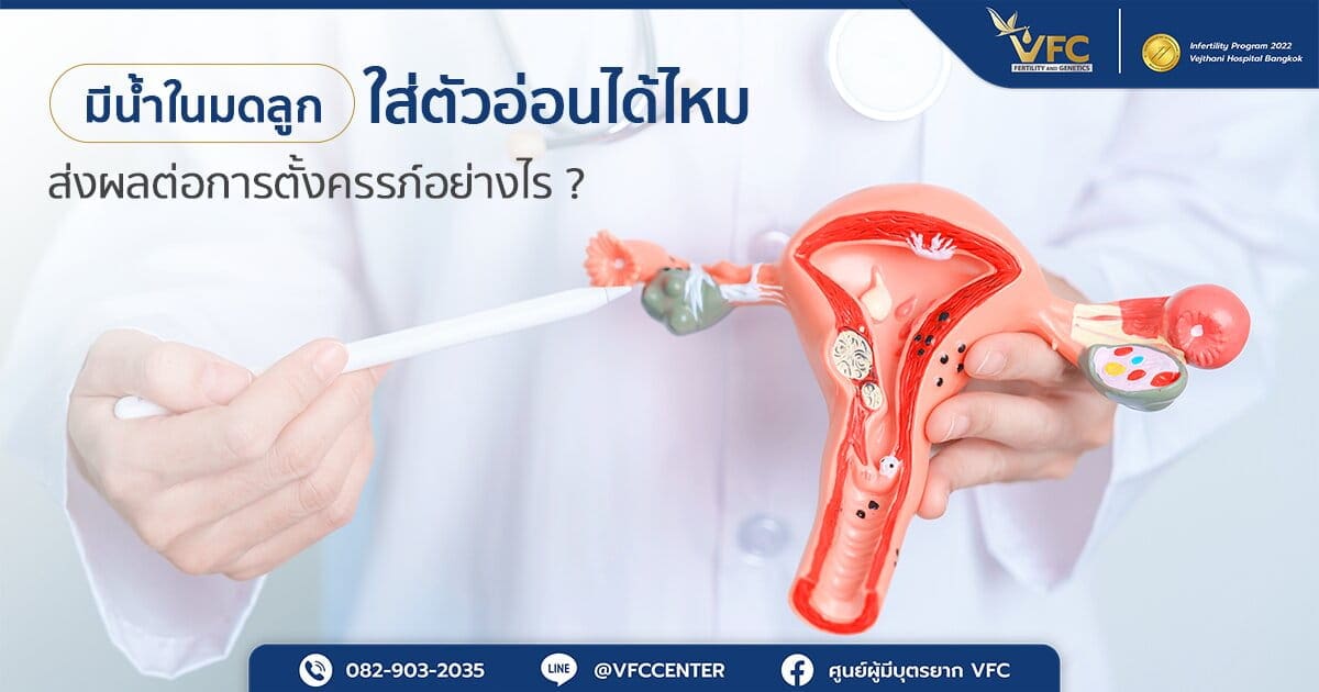 แพทย์ชี้ภาพจำลองมดลูก จุดที่สามารถเกิดน้ำในโพรงมดลูกก่อนใส่ตัวอ่อนได้