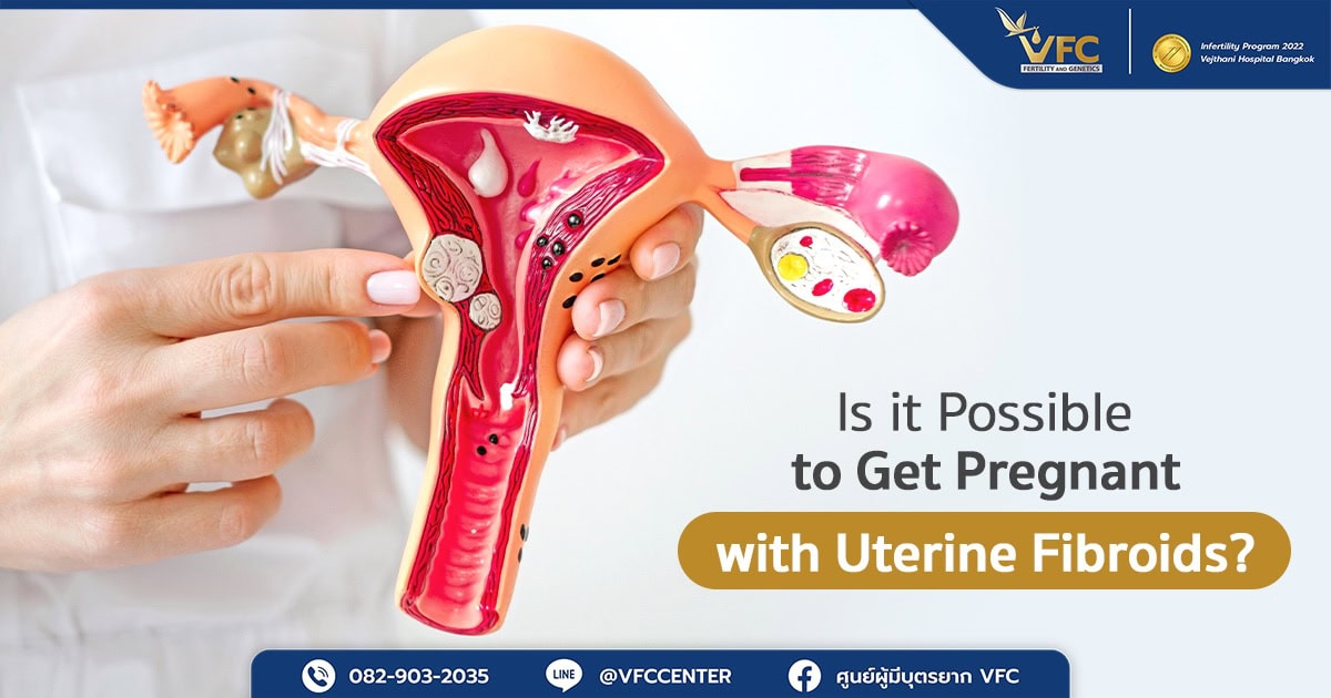 Preparing the uterus for successful ICSI in patients with uterine fibroids