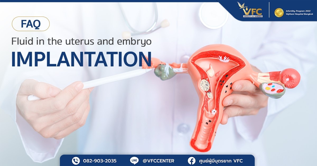 A doctor pointing to a uterine model showing where fluid in the uterine cavity before embryo transfer can occur.