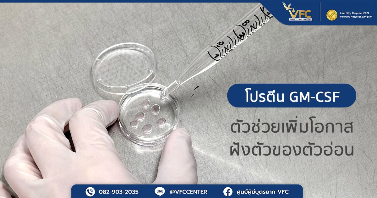 ถาดเพาะเลี้ยงตัวอ่อนผสม GM-CSF ในน้ำยา เพื่อช่วยเพิ่มโอกาสฝังตัวของตัวอ่อน