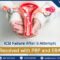 Precision medicine for thin endometrium embryo transfer timing