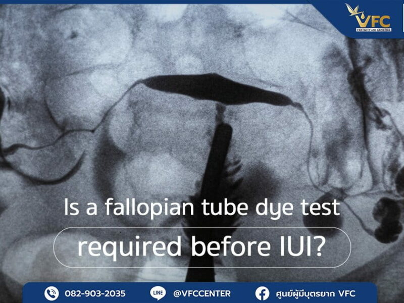 An X-ray image showing the results of a fallopian tube dye test (HSG).