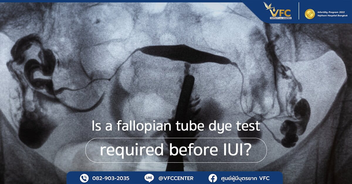 An X-ray image showing the results of a fallopian tube dye test (HSG).